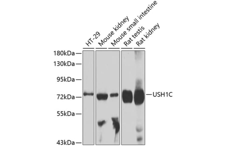 Western Blot - Anti-USH1C/Harmonin Antibody (A14553) - Antibodies.com