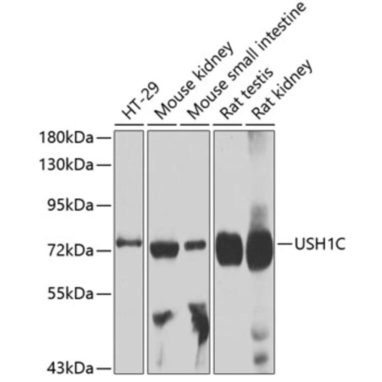Western Blot - Anti-USH1C/Harmonin Antibody (A14553) - Antibodies.com