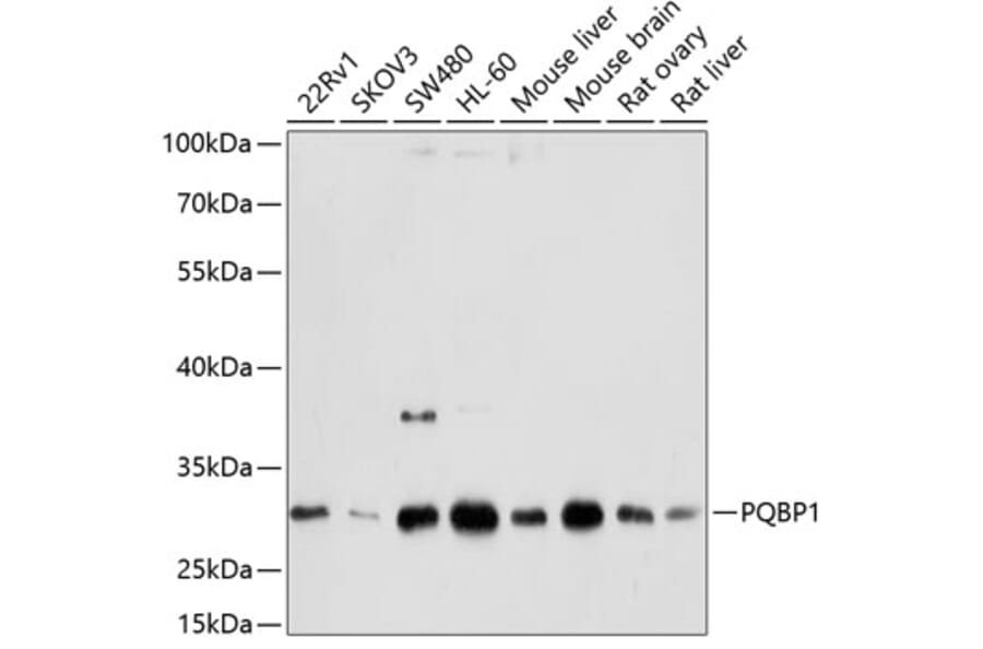 Western Blot - Anti-PQBP1 Antibody (A14554) - Antibodies.com