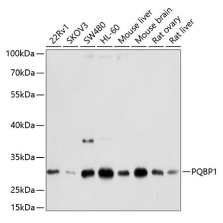 Western Blot - Anti-PQBP1 Antibody (A14554) - Antibodies.com