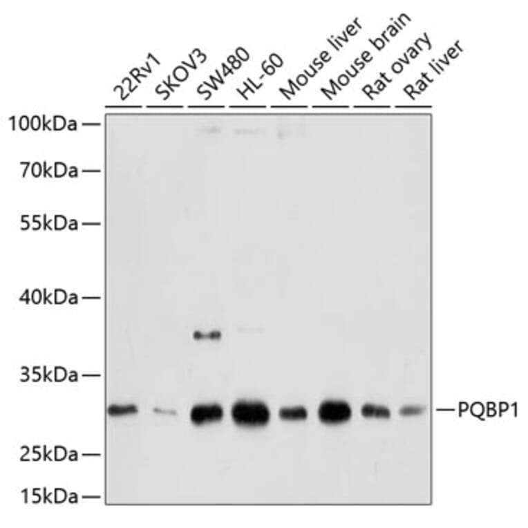 Western Blot - Anti-PQBP1 Antibody (A14554) - Antibodies.com