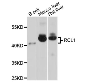 Western Blot - Anti-RCL1 Antibody (A4382) - Antibodies.com