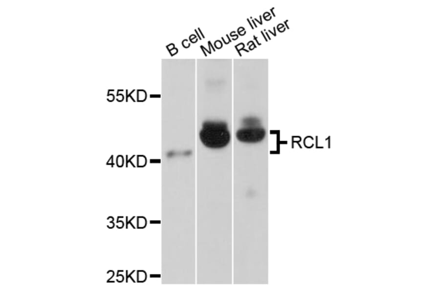 Western Blot - Anti-RCL1 Antibody (A4382) - Antibodies.com