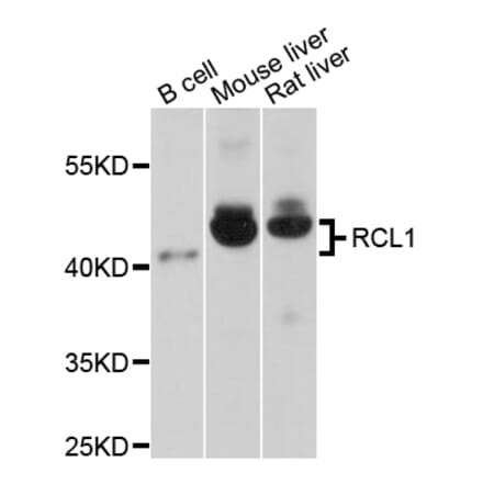 Western Blot - Anti-RCL1 Antibody (A14555) - Antibodies.com