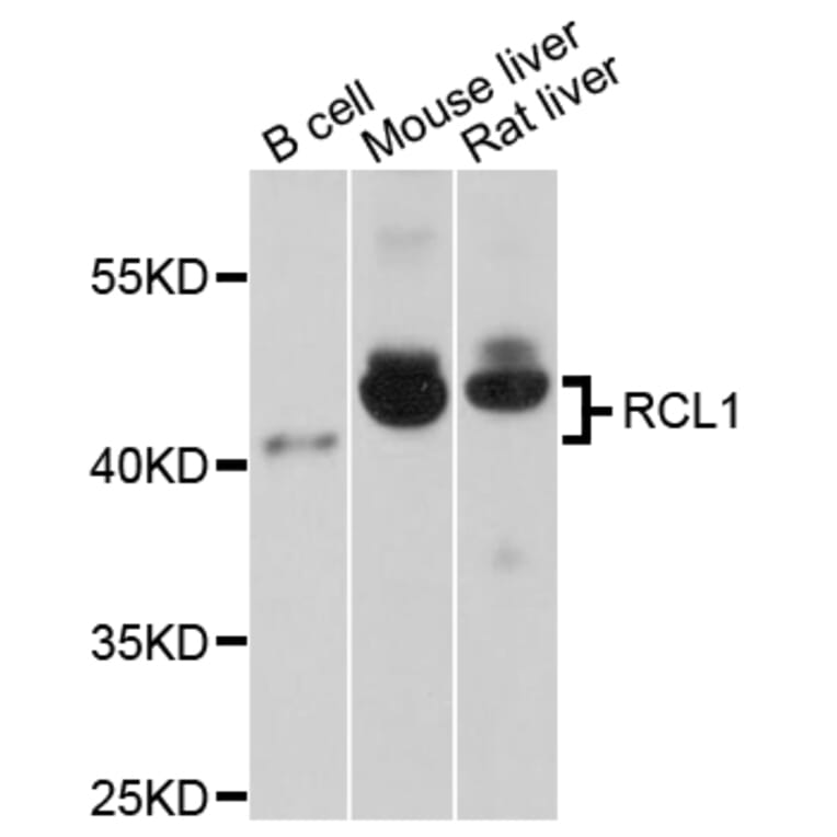 Western Blot - Anti-RCL1 Antibody (A4382) - Antibodies.com