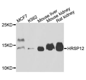 Western Blot - Anti-HRSP12 Antibody (A14556) - Antibodies.com