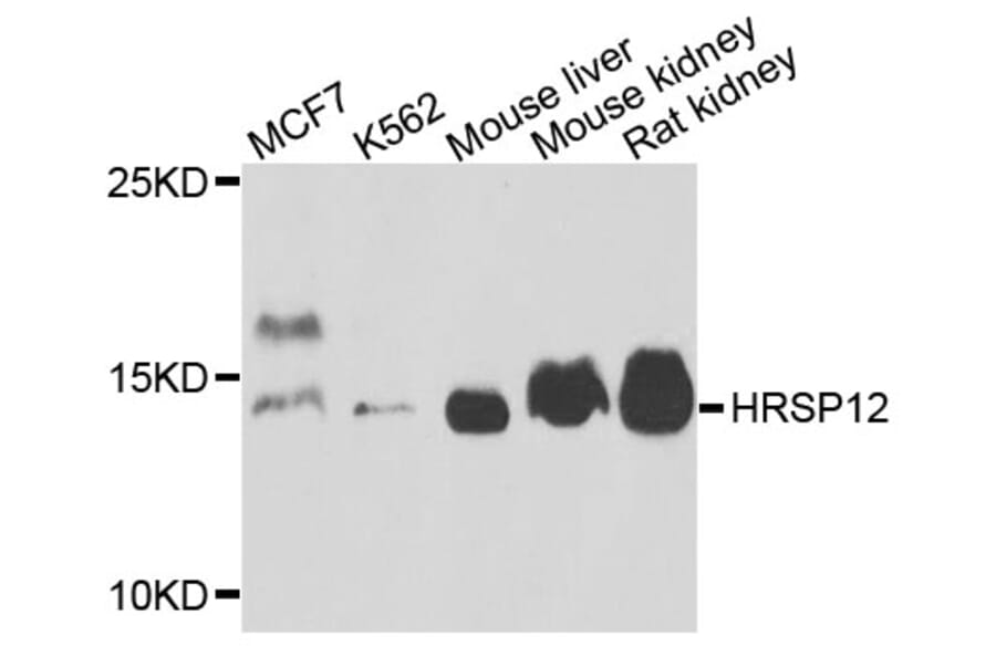 Western Blot - Anti-HRSP12 Antibody (A4392) - Antibodies.com