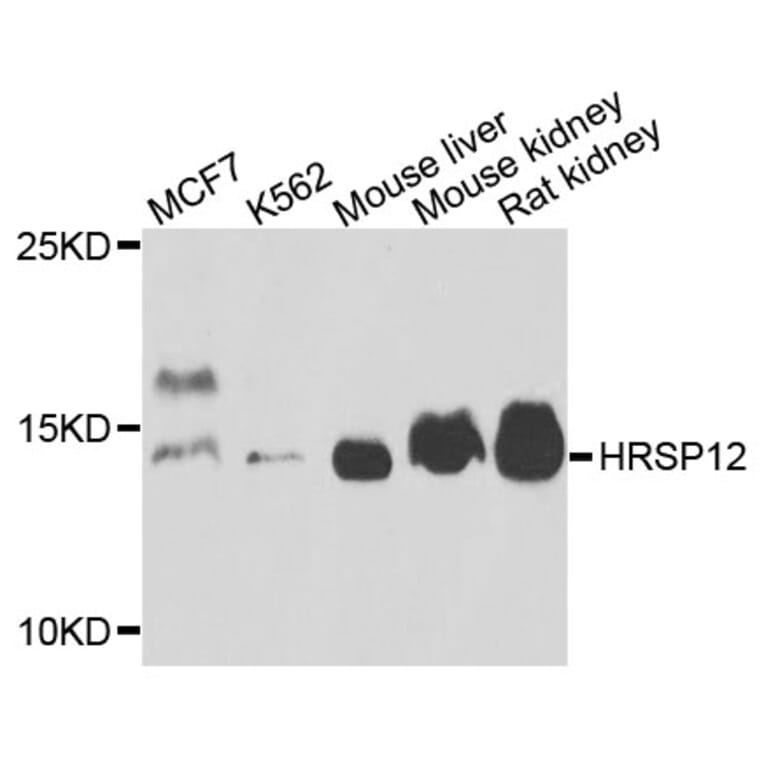 Western Blot - Anti-HRSP12 Antibody (A4392) - Antibodies.com