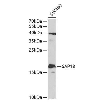 Western Blot - Anti-SAP18 Antibody (A14557) - Antibodies.com