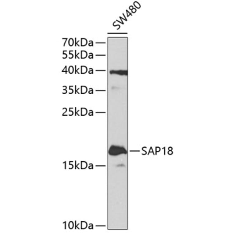 Western Blot - Anti-SAP18 Antibody (A14557) - Antibodies.com