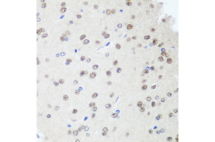 Immunohistochemistry - Anti-SAP18 Antibody (A14557) - Antibodies.com