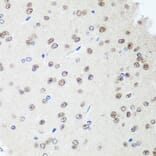 Immunohistochemistry - Anti-SAP18 Antibody (A14557) - Antibodies.com