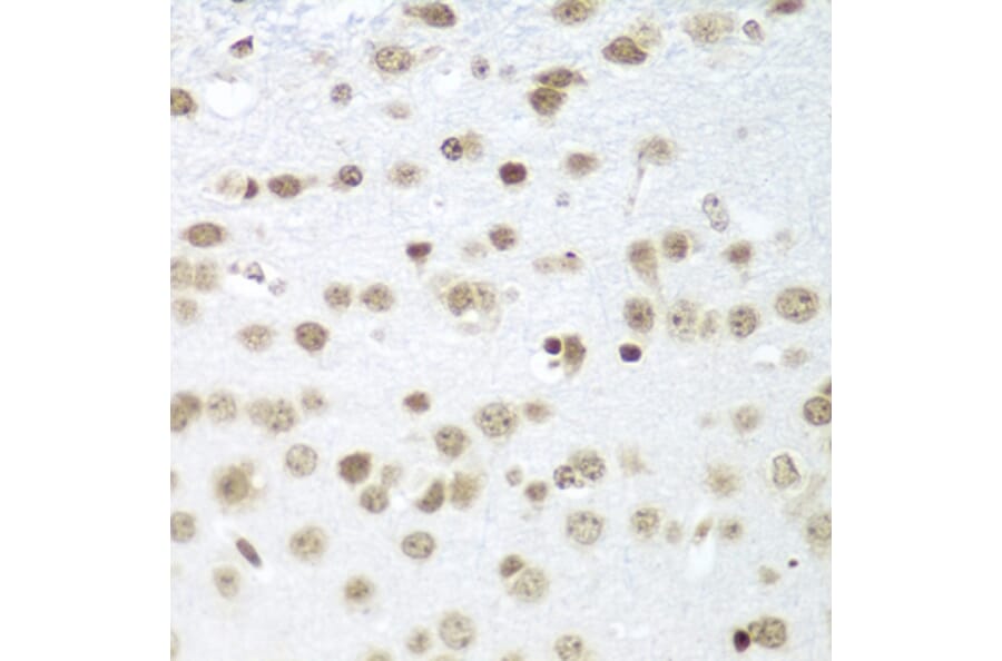 Immunohistochemistry - Anti-SAP18 Antibody (A14557) - Antibodies.com