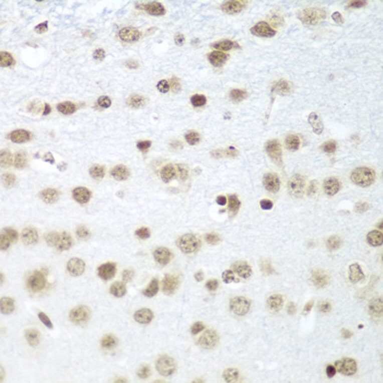 Immunohistochemistry - Anti-SAP18 Antibody (A14557) - Antibodies.com