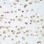 Immunohistochemistry - Anti-SAP18 Antibody (A14557) - Antibodies.com