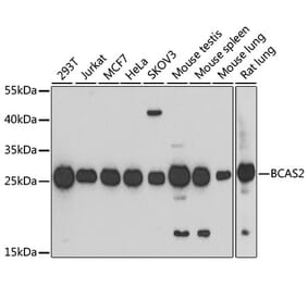 Western Blot - Anti-BCAS2 Antibody (A14558) - Antibodies.com