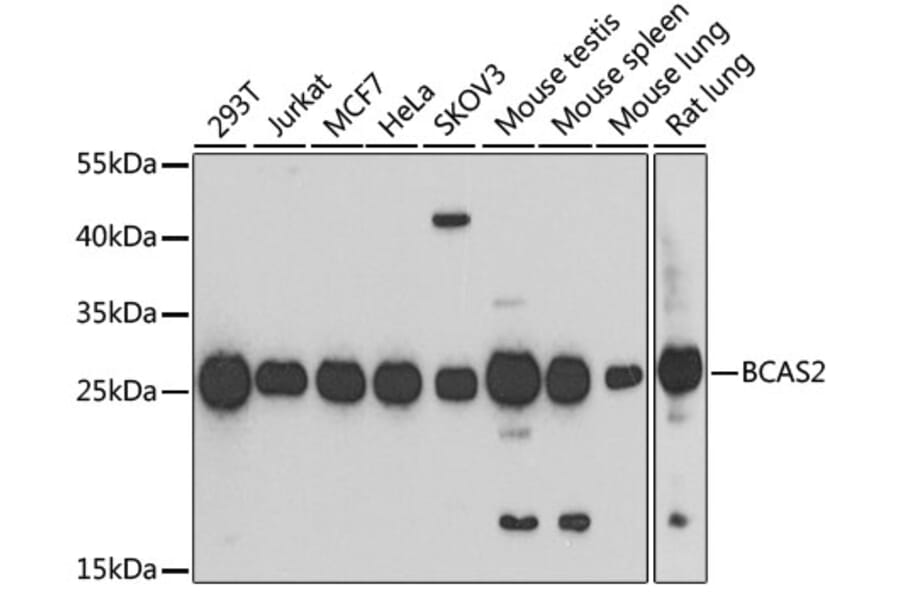 Western Blot - Anti-BCAS2 Antibody (A14558) - Antibodies.com