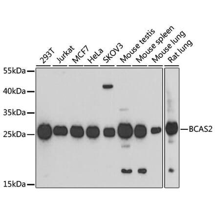 Western Blot - Anti-BCAS2 Antibody (A14558) - Antibodies.com