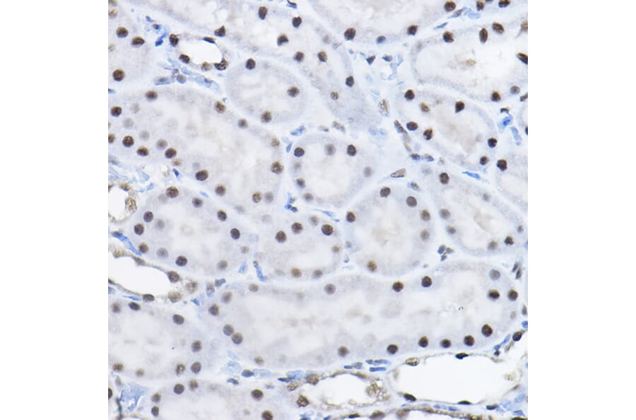 Immunohistochemistry - Anti-BCAS2 Antibody (A14558) - Antibodies.com