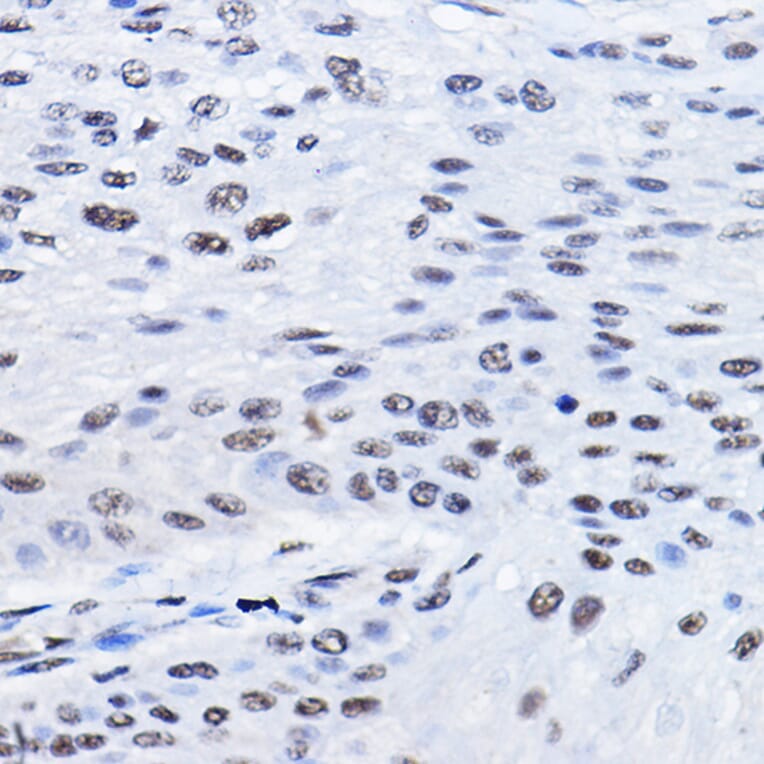 Immunohistochemistry - Anti-BCAS2 Antibody (A14558) - Antibodies.com