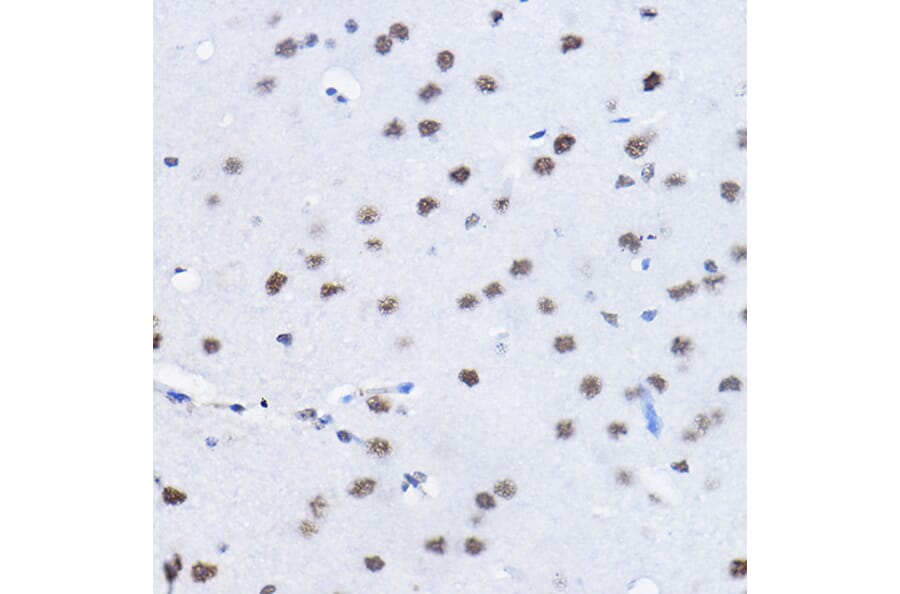 Immunohistochemistry - Anti-BCAS2 Antibody (A14558) - Antibodies.com