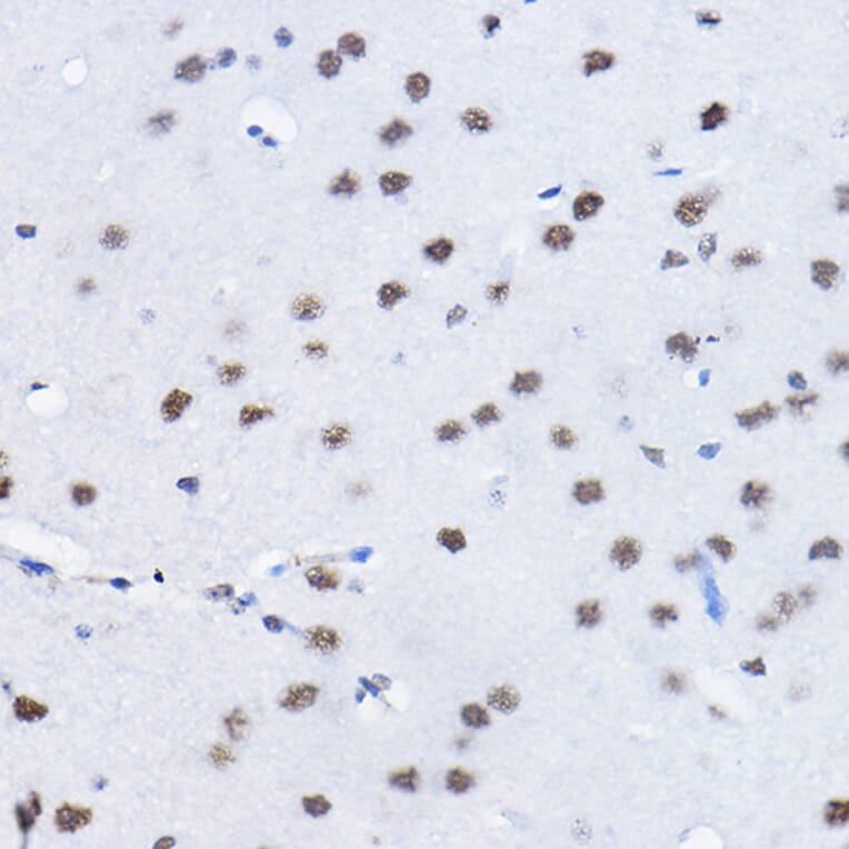 Immunohistochemistry - Anti-BCAS2 Antibody (A14558) - Antibodies.com