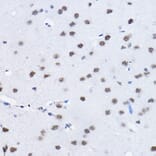 Immunohistochemistry - Anti-BCAS2 Antibody (A14558) - Antibodies.com