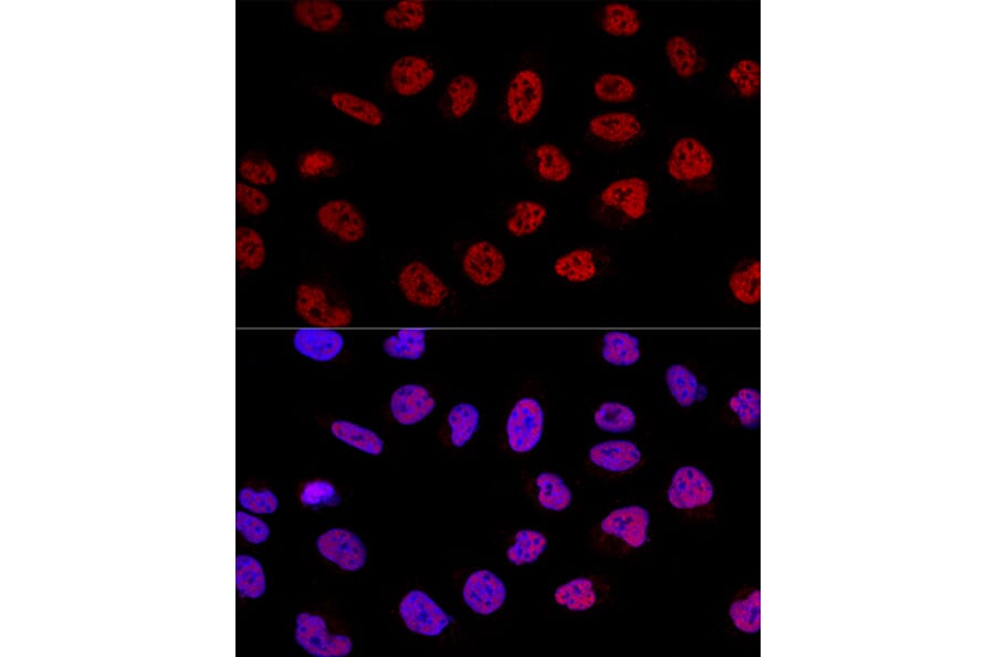Immunofluorescence - Anti-BCAS2 Antibody (A14558) - Antibodies.com