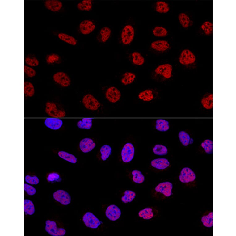Immunofluorescence - Anti-BCAS2 Antibody (A14558) - Antibodies.com