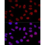 Immunofluorescence - Anti-BCAS2 Antibody (A14558) - Antibodies.com