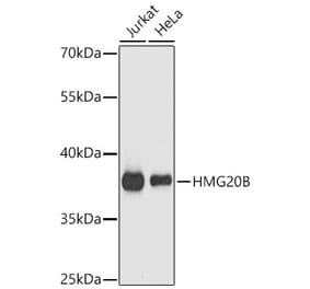 Western Blot - Anti-BRAF35 Antibody (A14559) - Antibodies.com