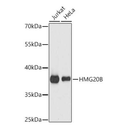Western Blot - Anti-BRAF35 Antibody (A14559) - Antibodies.com