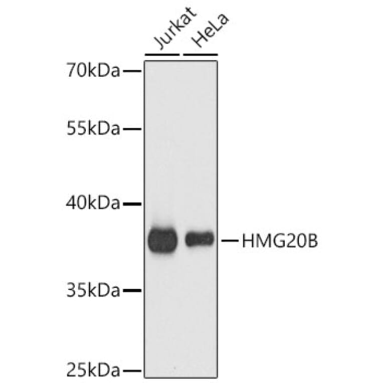 Western Blot - Anti-BRAF35 Antibody (A14559) - Antibodies.com