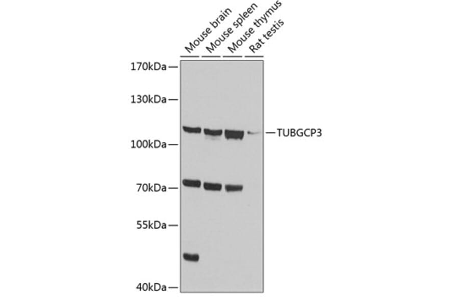 Western Blot - Anti-TUBGCP3 Antibody (A14560) - Antibodies.com