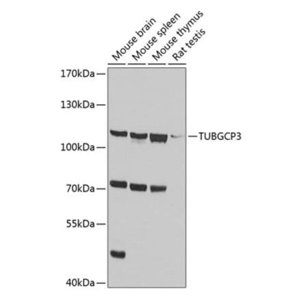 Western Blot - Anti-TUBGCP3 Antibody (A14560) - Antibodies.com