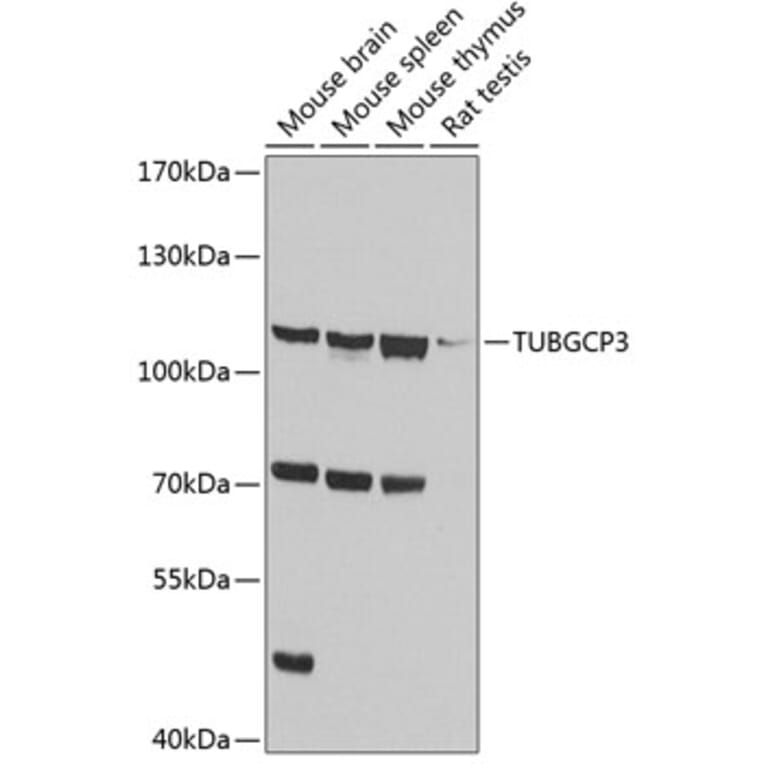 Western Blot - Anti-TUBGCP3 Antibody (A14560) - Antibodies.com