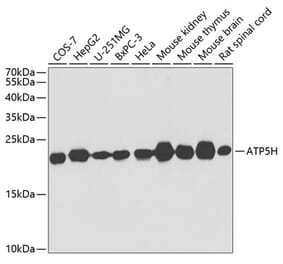 Western Blot - Anti-ATP5H Antibody (A14561) - Antibodies.com