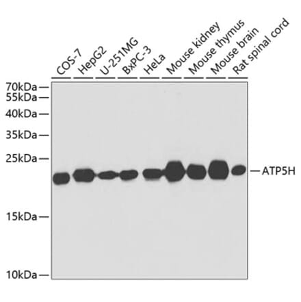 Western Blot - Anti-ATP5H Antibody (A14561) - Antibodies.com