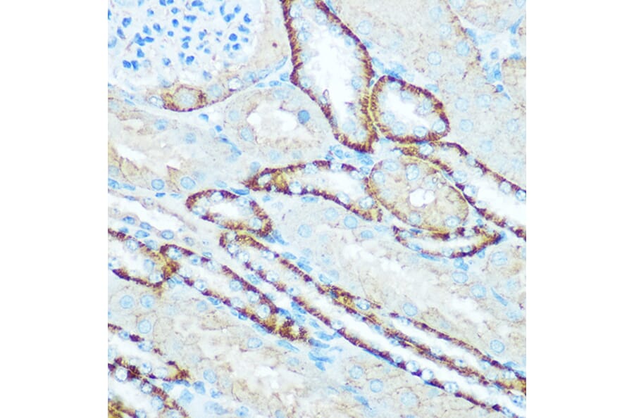 Immunohistochemistry - Anti-ATP5H Antibody (A14561) - Antibodies.com