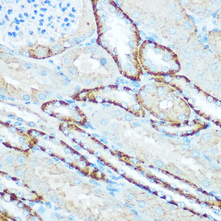 Immunohistochemistry - Anti-ATP5H Antibody (A14561) - Antibodies.com