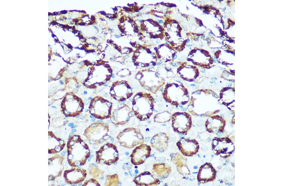 Immunohistochemistry - Anti-ATP5H Antibody (A14561) - Antibodies.com