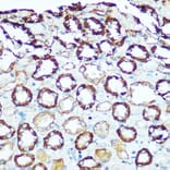 Immunohistochemistry - Anti-ATP5H Antibody (A14561) - Antibodies.com