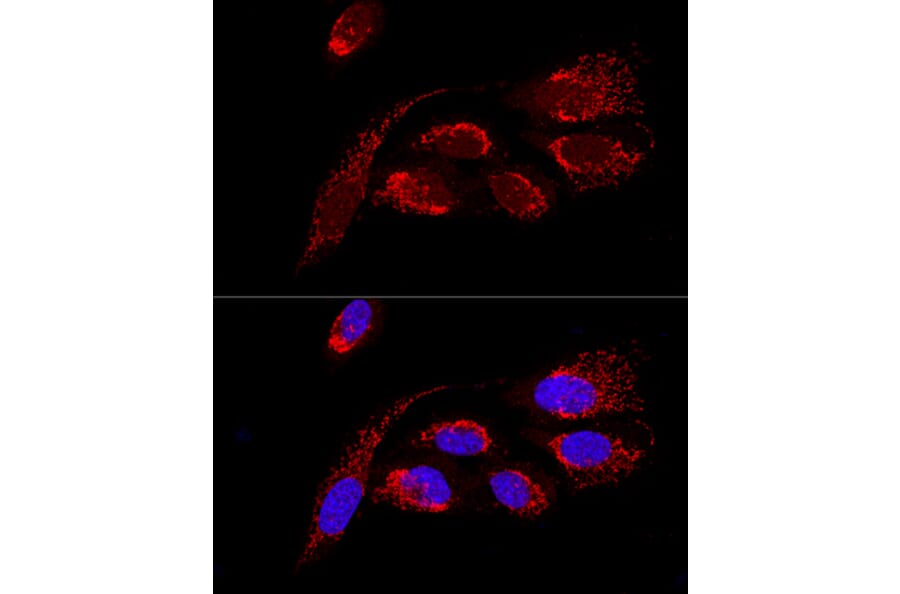 Immunofluorescence - Anti-ATP5H Antibody (A14561) - Antibodies.com