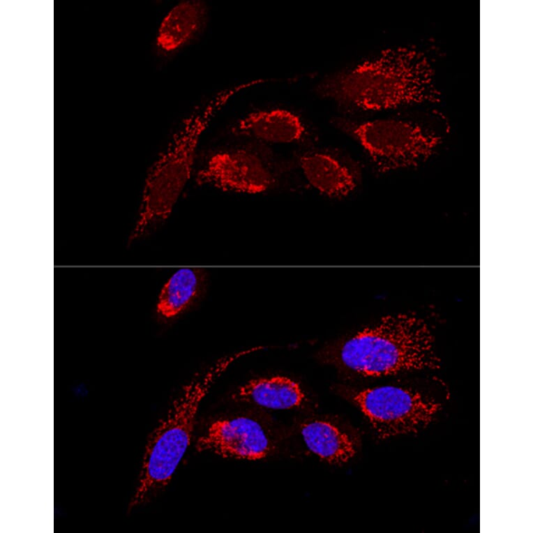 Immunofluorescence - Anti-ATP5H Antibody (A14561) - Antibodies.com