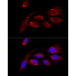 Immunofluorescence - Anti-ATP5H Antibody (A14561) - Antibodies.com
