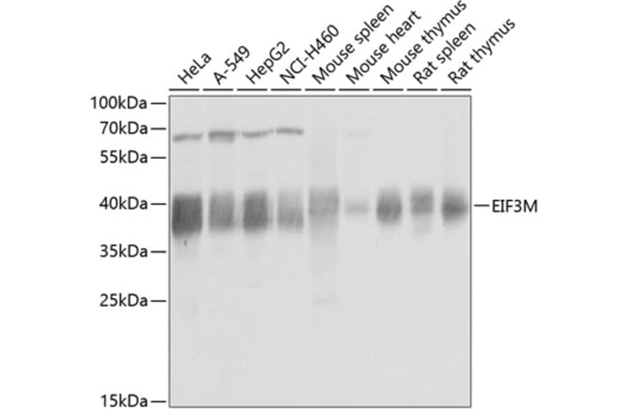 Western Blot - Anti-PCID1 Antibody (A14562) - Antibodies.com
