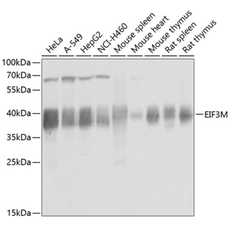 Western Blot - Anti-PCID1 Antibody (A14562) - Antibodies.com