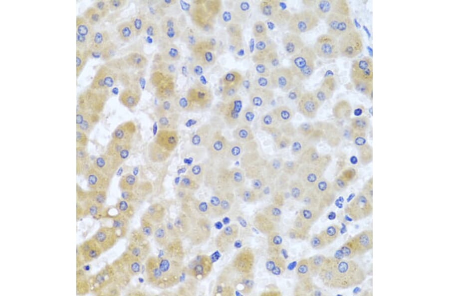 Immunohistochemistry - Anti-PCID1 Antibody (A14562) - Antibodies.com