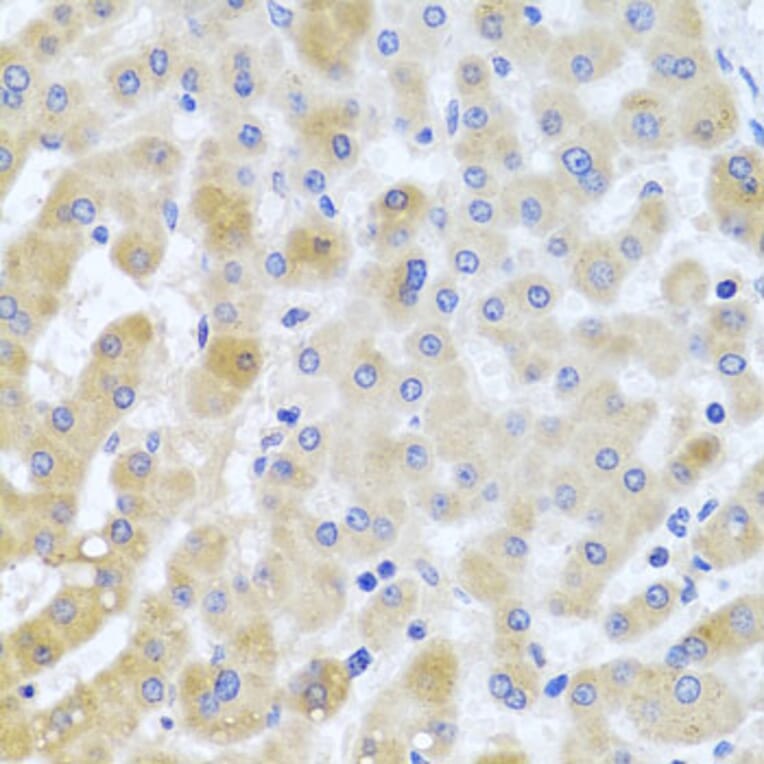Immunohistochemistry - Anti-PCID1 Antibody (A14562) - Antibodies.com