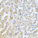 Immunohistochemistry - Anti-PCID1 Antibody (A14562) - Antibodies.com